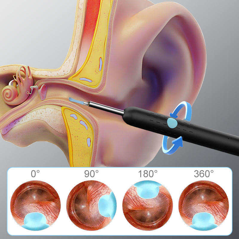Smart Ear Scope  30% OFF SALE
